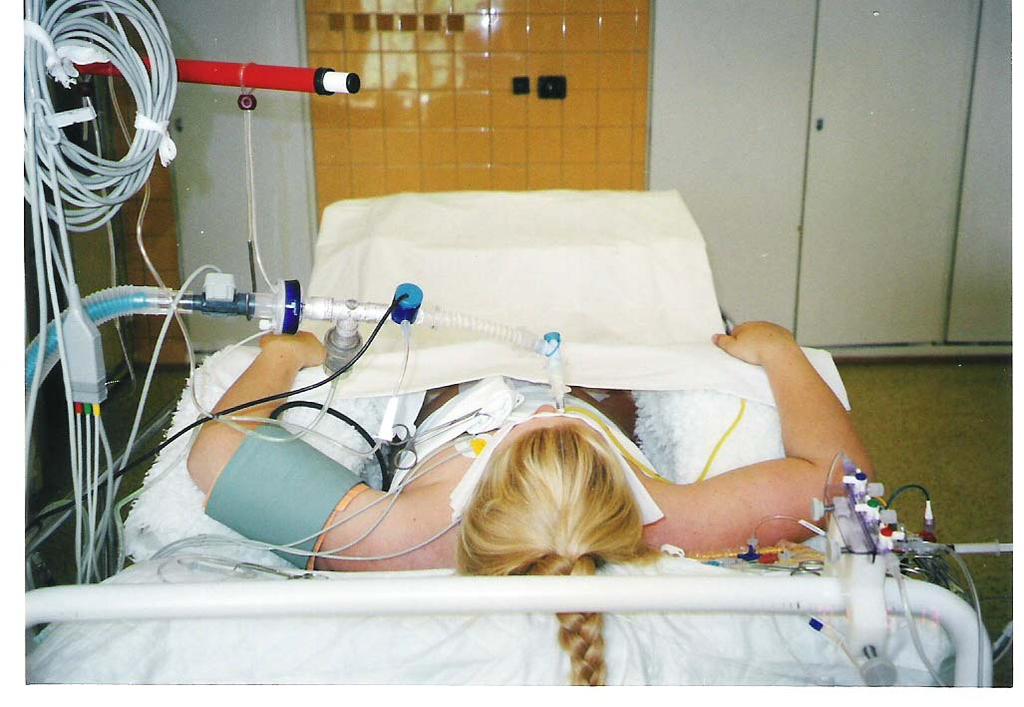 INDIKACE - Operační výkony - UPV v resuscitační péči - Bezvědomí a úrazy - Respirační
