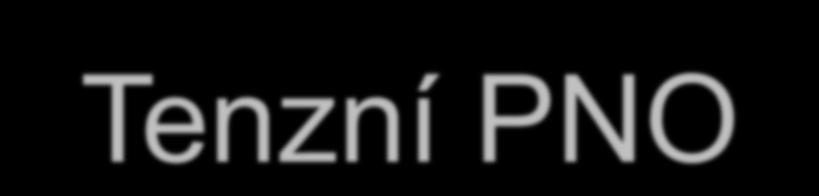 Tenzní PNO život ohrožující situace dislokace mediastinálních struktur a omezení