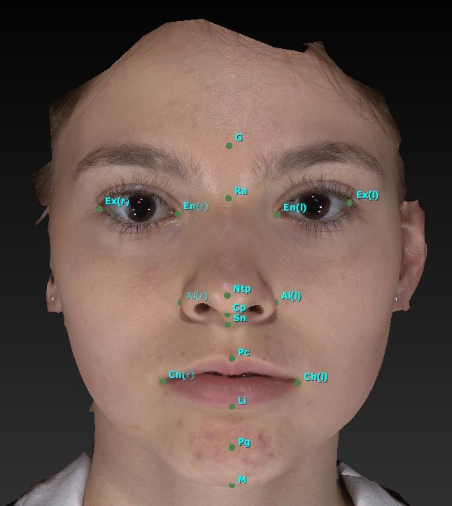 3D ANALÝZA OBLIČEJE DĚTÍ VE VĚKU 6 15 LET Autor: Michaela Lenochová a Marie Bednářová Školitel: MDDr.