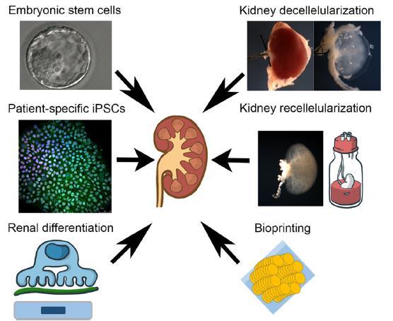 Regenerative strategies for kidney engineering