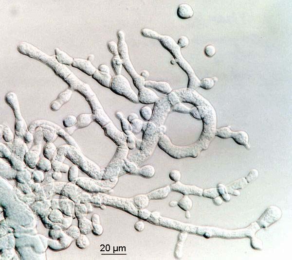 Chrysonilia sitophila
