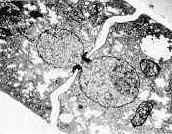 Septa Neurospora crassa (Ascomycota) Na