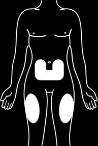 (břicho nebo stehno), jak je vyobrazeno na Obrázku 4.
