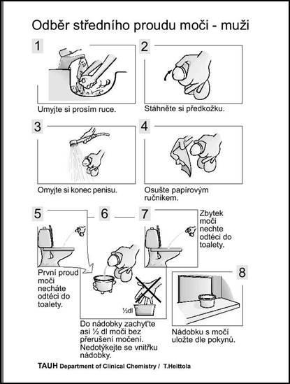 Jednorázový odběr vzorku moče - muži V následujících dnech Vám bude vyšetřena moč chemicky a morfologicky.