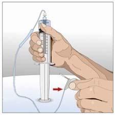 6. Připravte si injekční lahvičku rekombinantní lidské hyaluronidázy (HY): Vyjměte z obalu menší sterilní stříkačku a připojte ji k hrotu nebo jehle bez odvzdušnění (zařízení).