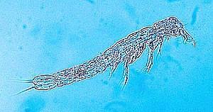 Malacostraca, CRUSTACEA BATHYNELLACEA (bezkrunýřky) slepí korýši podzemní intersticiální prostory písky a štěrky jezero Bajkal zadečkové konč. kromě 1.
