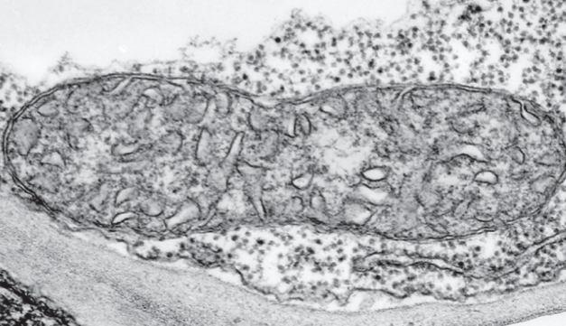 f) Mitochondrie a peroxizómy 11 Mitochondrie Elektrárna buňky aerobní dýchání, účastní se glukogeneze a fotorespirace; stovky tisíce v jedné buňce v závislosti na typu buňky a stádium vývoje; mladé