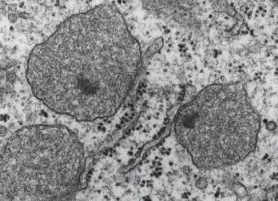 Peroxizómy 13 Sférické organely o průměru 0,2 2 µm;