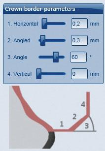 POUŽITÍ Okrajové parametry v CAD softwaru U Ceramill Zolid by se mělo dbát na to, aby byly tloušťky okraje dostatečné. Doporučené hodnoty jsou: _1. Tloušťka okraje (Horizontal): 0,2 mm _2.