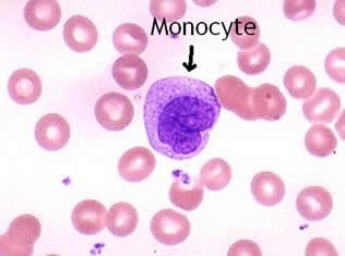 Monocyty CD14 HLA DR -