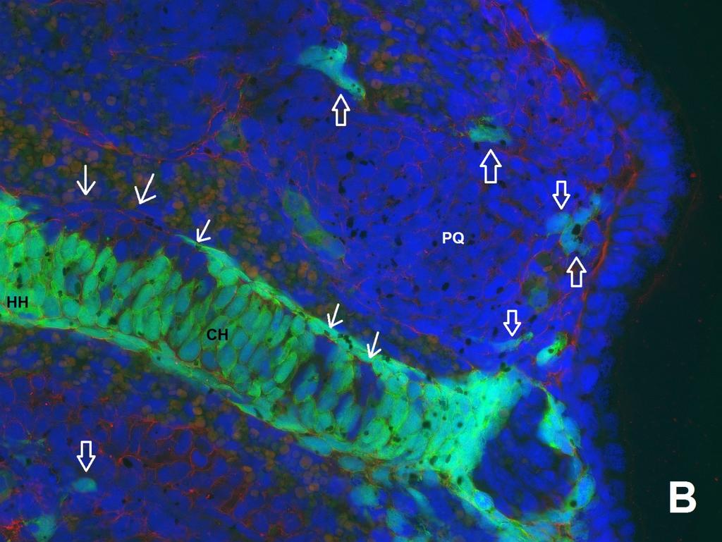 (B) Pravé ceratohyale jiného embrya.