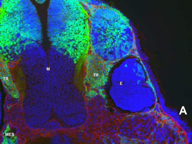 (A) Značení anterorní části mozku po transplantaci neurálních valů oblasti