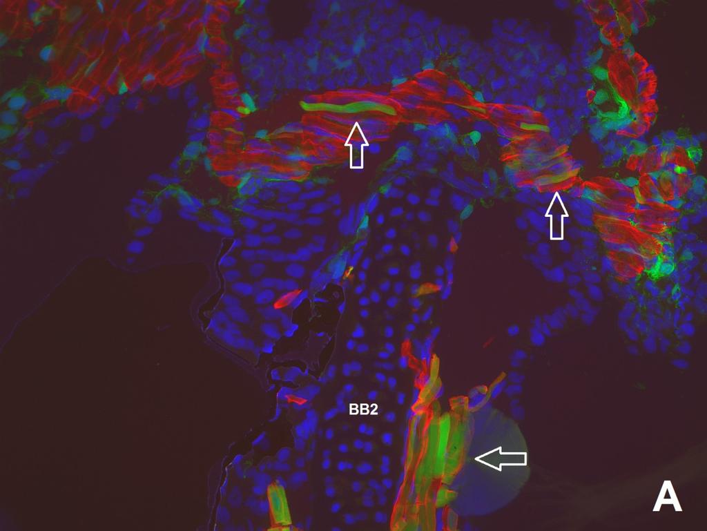 Výsledky Obr. 14 Dvojí původ značených buněk ve svalech. (A) Horizontální řez larvou velkou 19 mm.