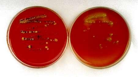 Salmonella spp.