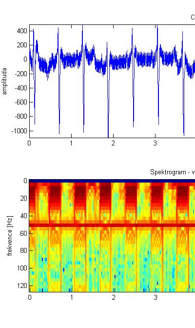 S aplikacemi se setkáváme v nejrůznějších oblastech, nám blízkých, jako jsou telekomunikace, v audiovizuální technice a multimediích či v biomedicínském inženýrství, ale i vzdálenějších, jako třeba v