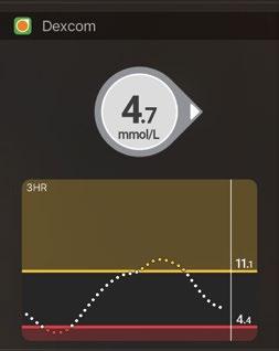 Zobrazení Dnes (pouze zařízení Apple) Přidejte informace ze systému Dexcom CGM do zobrazení Dnes. Nastavení 1. Otevřete zobrazení Dnes. Podrobnosti naleznete v pokynech k chytrému zařízení. 2.