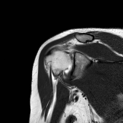 Anatomie m. supraspinatus tendo capitis long. m. bicipitis brachii m.