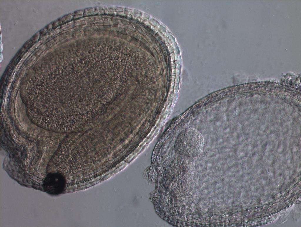 13) 4) Fotograficky zdokumentovat fenotyp pylových zrn a spočítat procentuální zastoupení fenotypu na 100 pylových zrn (mutant i WT) Embrya 1) Na sklíčka nalepit oboustrannou lepicí pásku a přilepit