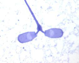 Proximální kapénka Proximální kapénka Parciální absence mitochondriální spirály Obr.12 Kulovitá hlavička Obr.13 Hřebenovitá hlavička Obr.14 Amorfní hlavička Obr.