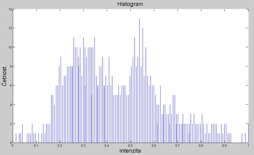 První snímek je pro ledvinu bez kontrastní látky a druhý snímek zobrazuje histogram ledviny s