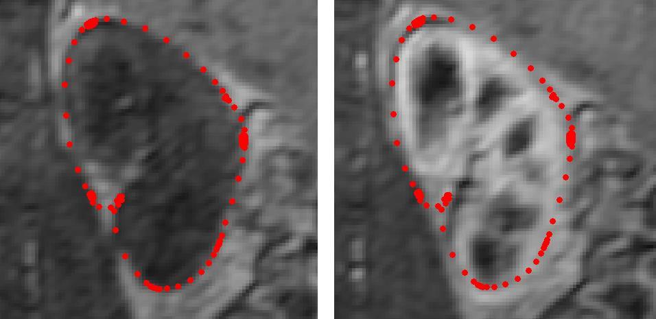 7.3 Segmentace 4D snímků Cílem celé segmentace je vysegmentování snímků ve všech časech snímání. Dosud byla prováděna segmentace ledviny v jednom čase.