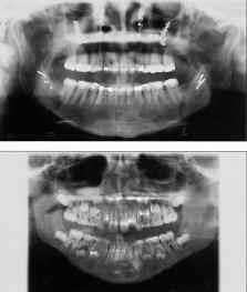Rentgenové přístroje v zubním