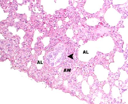 Výstupy a Výsledky 2007: MIGRACE schistosomula v cévě - kachna 5 schistosomula v bronchu - kachna schistosomula v alveolu - kachna Stěžejní