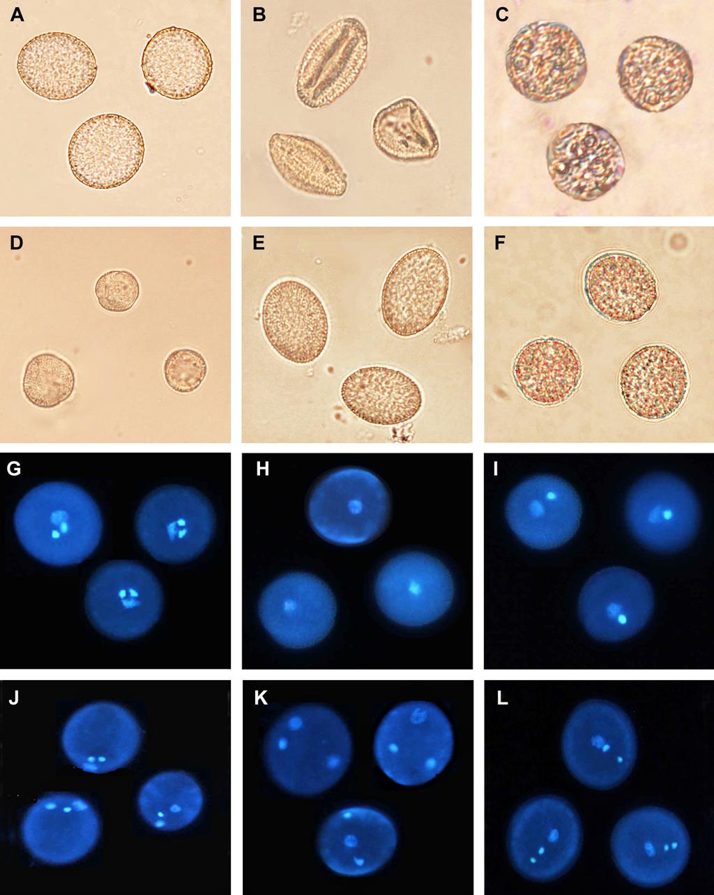 Obr. 10. Příklady fenotypových defektů mutantních pylových zrn huseníčku ve světlém poli (A-F) a při užití fluorescence (G-L).