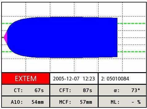 TESTY - EXTEM EXTEM aktivace koagulace prostřednictvím tkáňového faktoru (tromboplastin) obdoba PT koag.