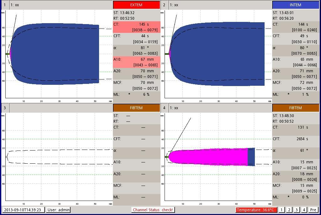 Warfarin - INR 3 EXTEM CT