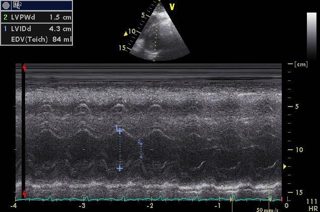 tlak - Low SVR, ESA