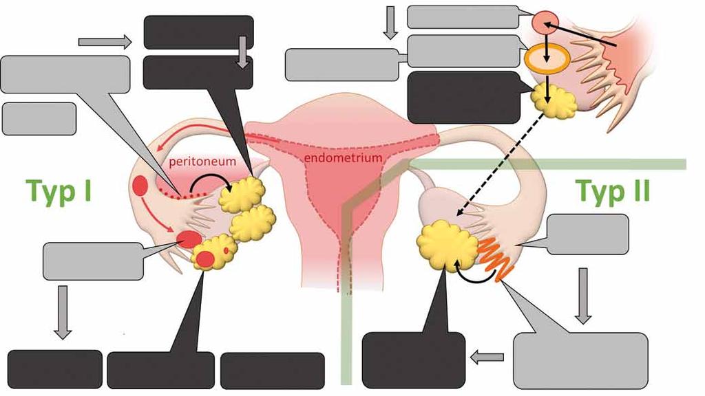 A ERBB2/KRAS/BRAF RNF43 přechodný tuboperitoneální epitel teratom Brennerův tumor mucinózní karcinom B ERBB2, PIK3CA, KRAS, BRAF nilgsc/borderline tumor inkluzní cysta APST/serózní borderline tumor