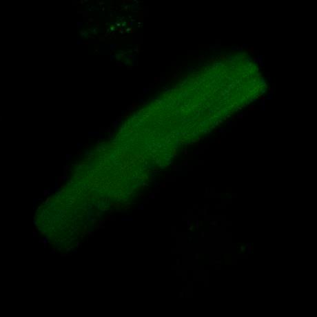 Příloha 5: Intenzitní snímky kardio-myocytů pro zelené fluorescenční barvivo calcein, akviziční dobu 0 až 11,5 ns a zisk detektorů 58 % jednotlivé obrázky zobrazují následující