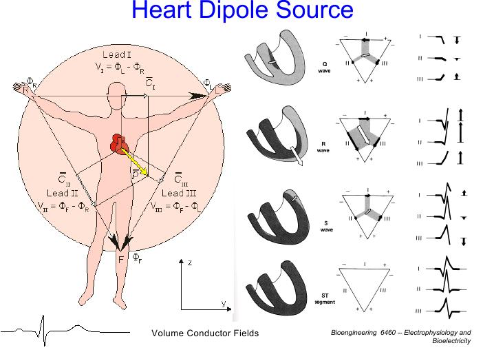 Einthovenův trojúhelník Elektrický dipól srdce Tento obrázek obsahuje často pomíjený problém kdyby vypadal E.