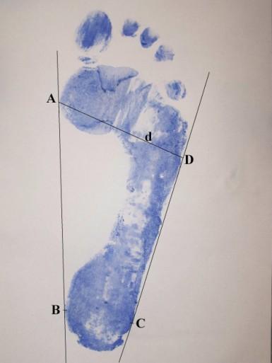 3.4.1 Predikce hmotnosti těla z trasologických stop Po získání plantogramu bylo třeba měřit parametry potřebné k výpočtům, což je znázorněno na obrázku 3.7.