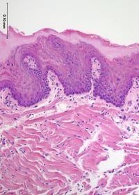 Stavba vnitřní strany Sliznice (tunica mucosae) Lamina epithelialis = epitel epitel vrstevnatý dlaţdicový Lamina propria mucosae = slizniční