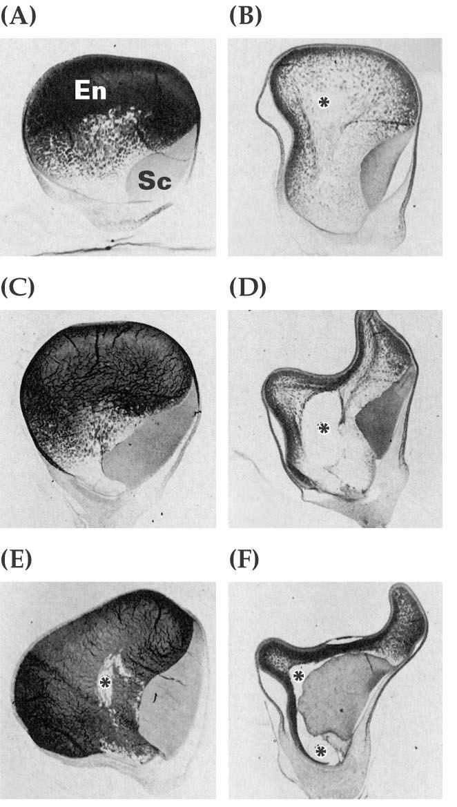 17 PCD endospermu a aleuronových buněk - - 2.