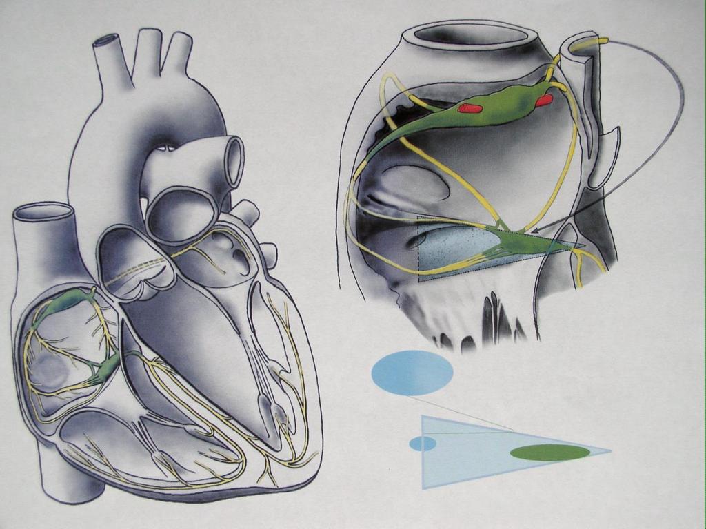Převodní systém srdeční 1.SA uzel, 2.