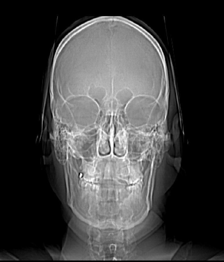 radiodiagnostiky Obrázek 7 CBCT transverzální řez