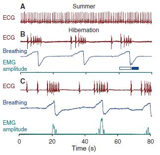 ECG (EKG) a záznam dechu medvědů v průběhu léta a při hibernaci A : ECG medvěda