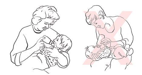 Obrázek 6 Správná a nesprávná poloha při krmení kojence (Children s Minnesota, 2016) Hypotonie Ve spolupráci s matkou dítěte a fyzioterapeutem vyškoleným ve Vojtově metodice reflexní lokomoce je
