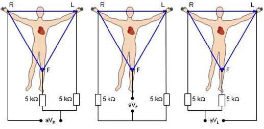 Jedna elektroda se zvolí jako měřící, zbylé dvě se spojí přes rezistor. Měří se rozdíl potenciálů mezi měřící elektrodou a výstupem spojených elektrod. Obrázek 1.