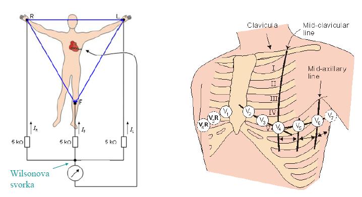 Obrázek 1.4: Vlevo: vytvoření Wilsonovy svorky; Vpravo: umístění elektrod hrudních svodů (2) 1.2 Popis EKG signálu Obrázek 1.