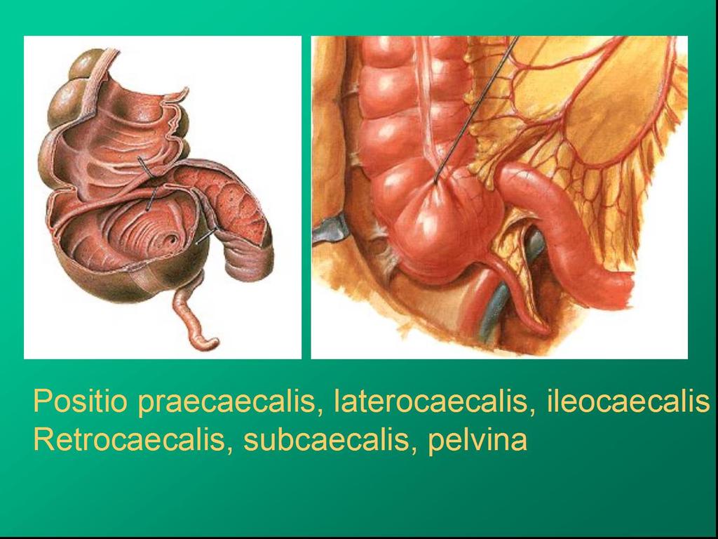 ústí apendixu ústí ilea caecum ileum appendix