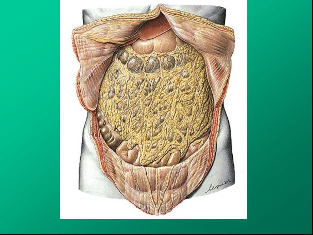 omentum majus colon