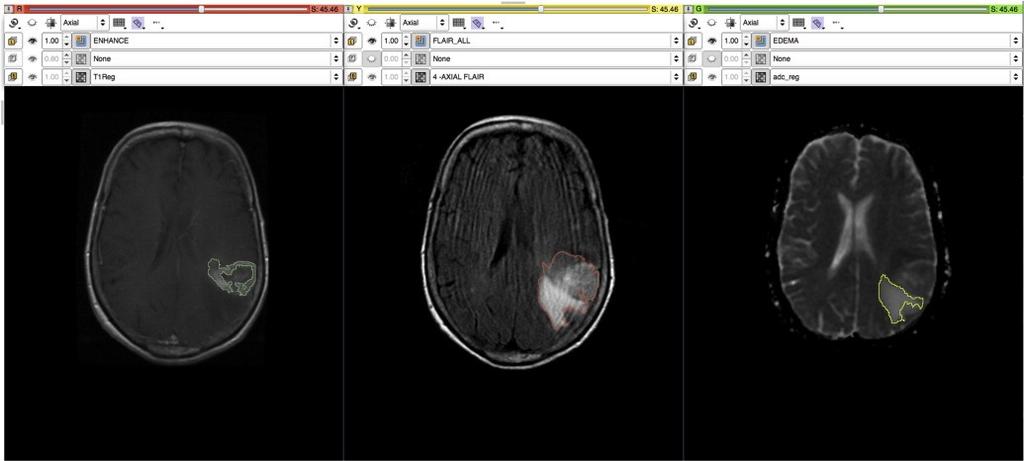 Rešerše komerčních SW pro diagnostiku mozku 5 Rešerše komerčních SW pro diagnostiku mozku Tato část se věnuje krátkému výčtu vybavení, které lze použít pro práci s obrazovými MRI daty.
