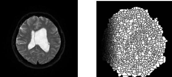 Rešerše metod k detekci patologických oblastí mozku z dat MR 6.
