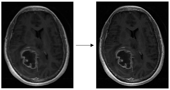 Modelování zájmových objektů z MR mozku 7.2.1 Ostření obrazu Cílem ostření obrazu je upravit obraz tak, aby se v něm nacházely strmější hrany. Tomu odpovídá zdůraznění vysokých frekvencí.