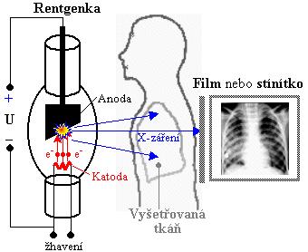 3. Radiodiagnostické zobrazovací metody využívající ionizujícího záření Radiologie je lékařský obor, který zahrnuje všechny diagnostické metody využívající ionizujícího záření (skiagrafie, rentgenová