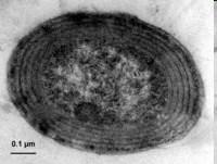 Prochloroccoccus,